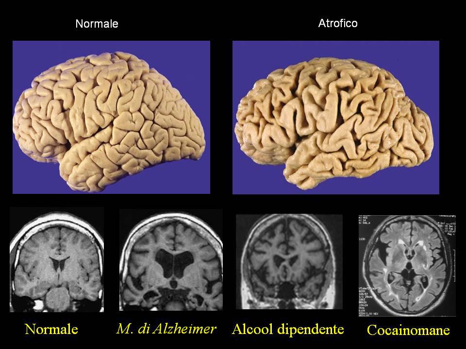 15_foto_alcol e droga (7)